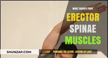 Understanding Tight Erector Spinae Muscles: Causes and Contributing Factors