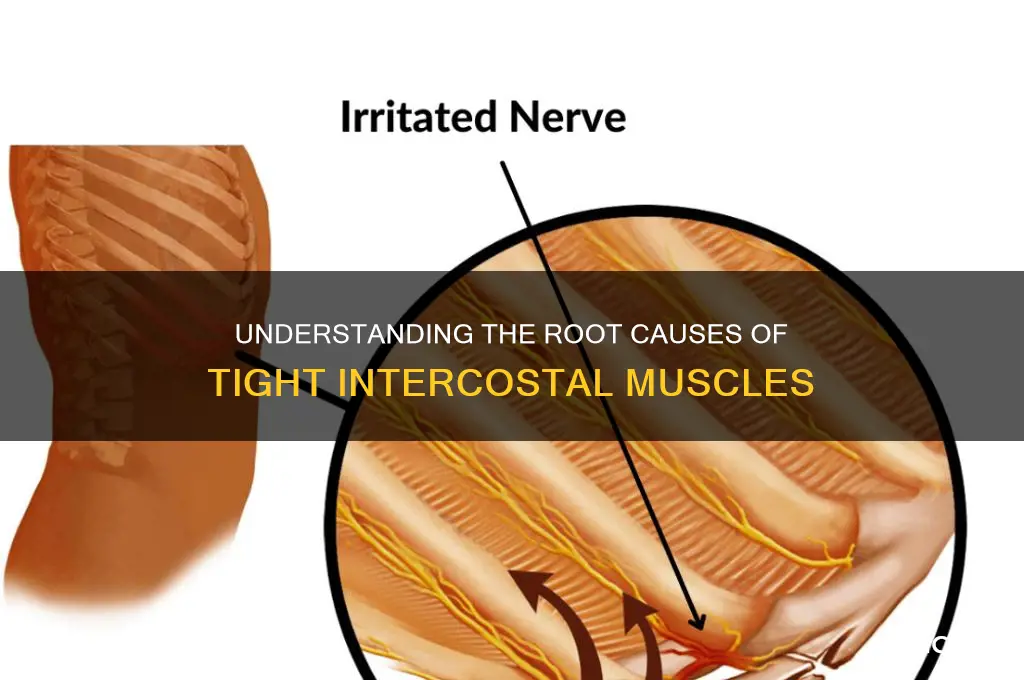 what causes tight intercostal muscles