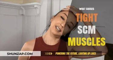 Understanding the Root Causes of Tight SCM Muscles: A Comprehensive Guide