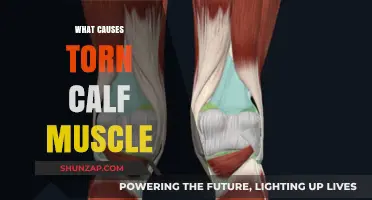 Understanding Torn Calf Muscles: Causes, Risks, and Prevention Tips
