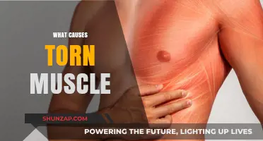 Understanding Torn Muscles: Causes, Risks, and Prevention Strategies