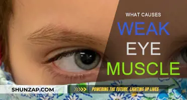 Weak Eye Muscles: Causes and Underlying Reasons