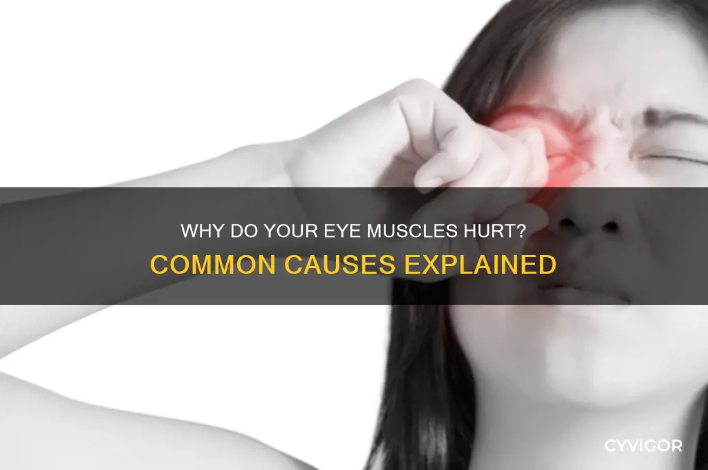 what causes your eye muscles to hurt
