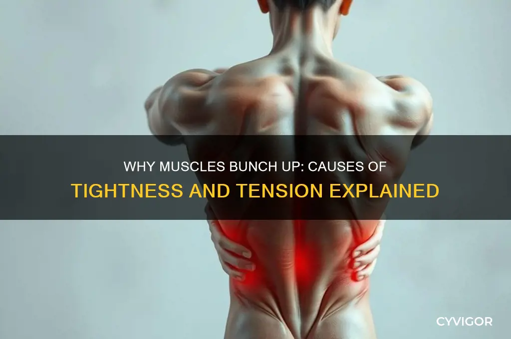 what causes your muscles to bunch up and be tight