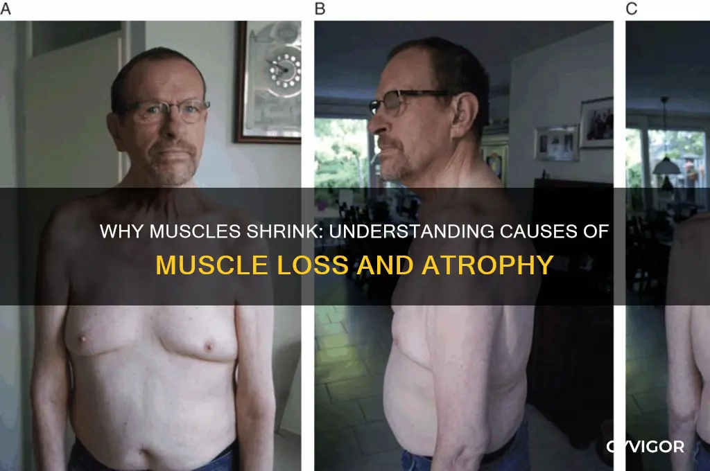 what causes your muscles to go away