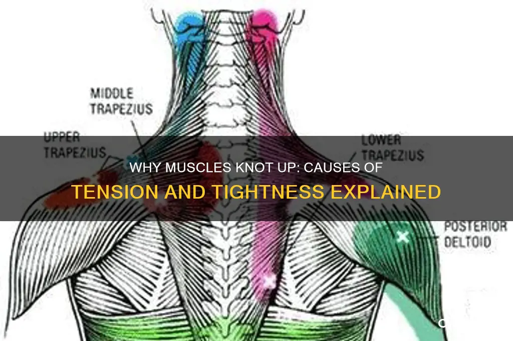 what causes your muscles to knot up
