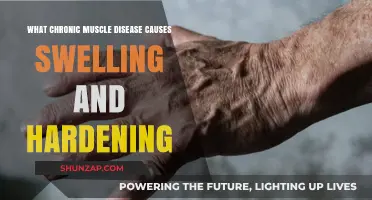 Understanding Chronic Muscle Disease: Causes of Swelling and Hardening Explained