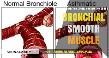 Bronchial Smooth Muscle Contraction: Understanding the Underlying Medical Condition