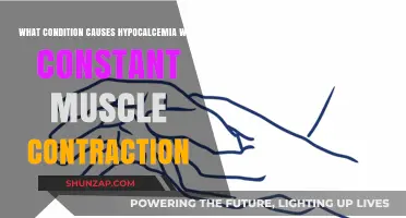 Hypocalcemia and Muscle Contractions: Understanding the Link to Tetany