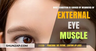 Weak External Eye Muscles: Understanding the Cause of Strabismus