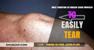Muscle Tears: Uncovering Conditions That Increase Vulnerability to Injury