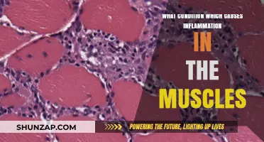 Understanding Polymyositis: The Inflammatory Muscle Condition Explained