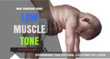 Understanding Low Muscle Tone: Causes, Conditions, and Contributing Factors