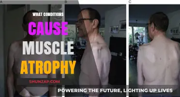 Understanding Muscle Atrophy: Causes, Conditions, and Contributing Factors Explained