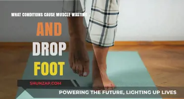 Muscle Wasting and Drop Foot: Causes and Conditions Explained