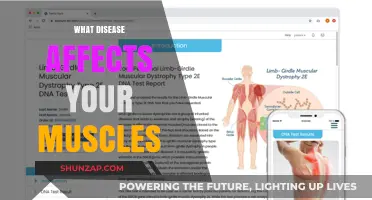 Understanding Muscular Dystrophy: A Comprehensive Guide