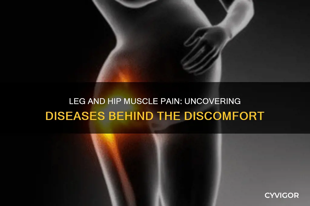 what disease can cause muscle pain in legs and hips
