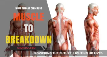 Muscle Breakdown: Diseases That Cause Muscle Wasting Explained