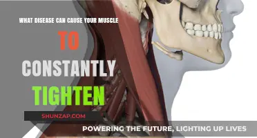 Understanding Dystonia: The Disease Behind Constant Muscle Tightening