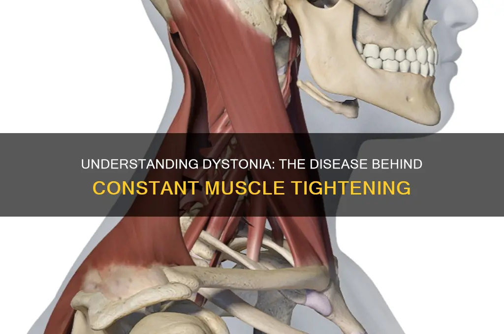 what disease can cause your muscle to constantly tighten