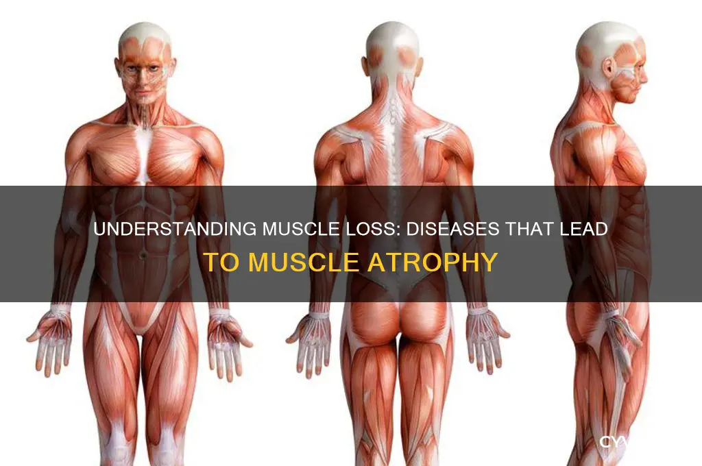 what disease cause muscle loss