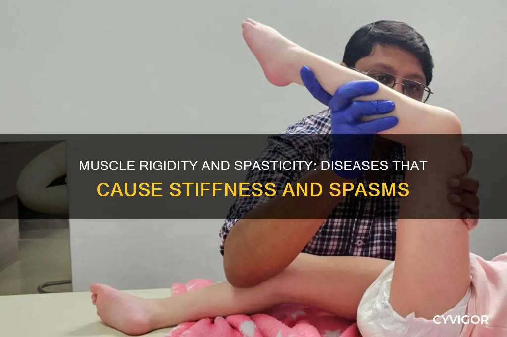what disease cause muscle rigidity and spasticity
