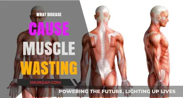Understanding Muscle Wasting: Diseases That Lead to Muscle Loss