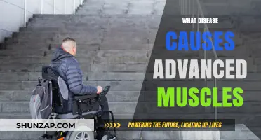 Understanding Muscular Dystrophy: The Disease Behind Advanced Muscle Degeneration