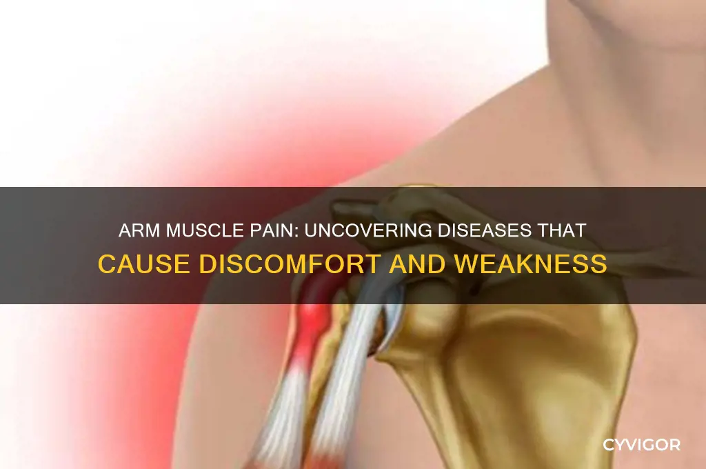 what disease causes arm muscles to hurt