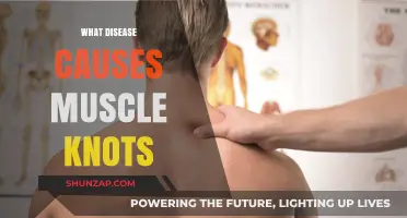 Unraveling Muscle Knots: Diseases That Cause Persistent Tension and Pain