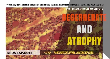 Muscle-Wasting Diseases: Understanding Causes of Degeneration and Atrophy
