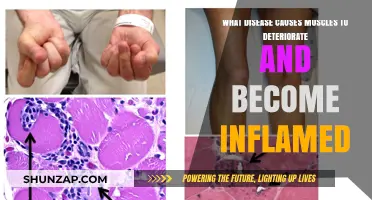Understanding Myositis: The Inflammatory Disease Causing Muscle Deterioration