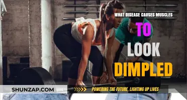 Understanding Cellulitis: The Disease Behind Dimpled Muscles Explained