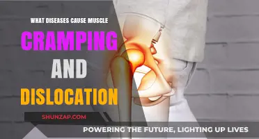 Muscle Cramps and Dislocations: Diseases That Could Be the Cause