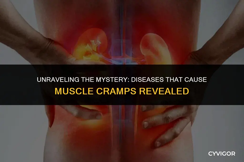 what diseases have muscle cramps as a symptom
