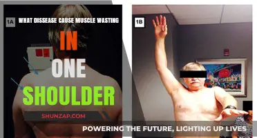 Shoulder Muscle Wasting: Uncovering Diseases Behind Uneven Atrophy