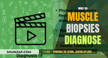 Muscle Biopsy: Diagnosing Muscle Disorders and Diseases