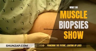 Muscle Biopsy Insights: Understanding the Intricacies of Muscle Health
