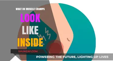 Unveiling the Hidden World of Muscle Cramps: An Inside Look