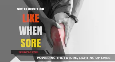 Understanding Sore Muscles: Visual Signs and What They Mean