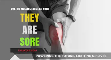 Understanding Sore Muscles: Visual Signs and What They Indicate