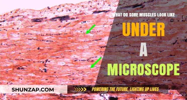 Microscopic Muscle Insights: Visualizing Sore Muscles Under the Microscope