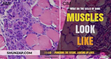 Unveiling Sore Muscles: Microscopic Insights into Damaged Muscle Cells