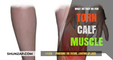 Effective Treatments and Recovery Tips for a Torn Calf Muscle