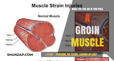 Pulled Groin Muscle: Effective Recovery Tips and Treatment Strategies
