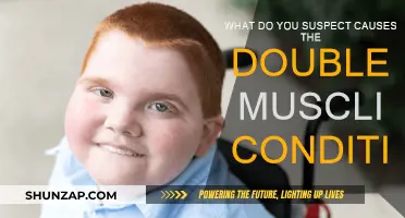 The Mystery Behind Double Muscling Condition