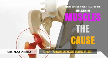 Hip Replacement Secrets: Uncovering Muscle-Related Causes Doctors Often Overlook