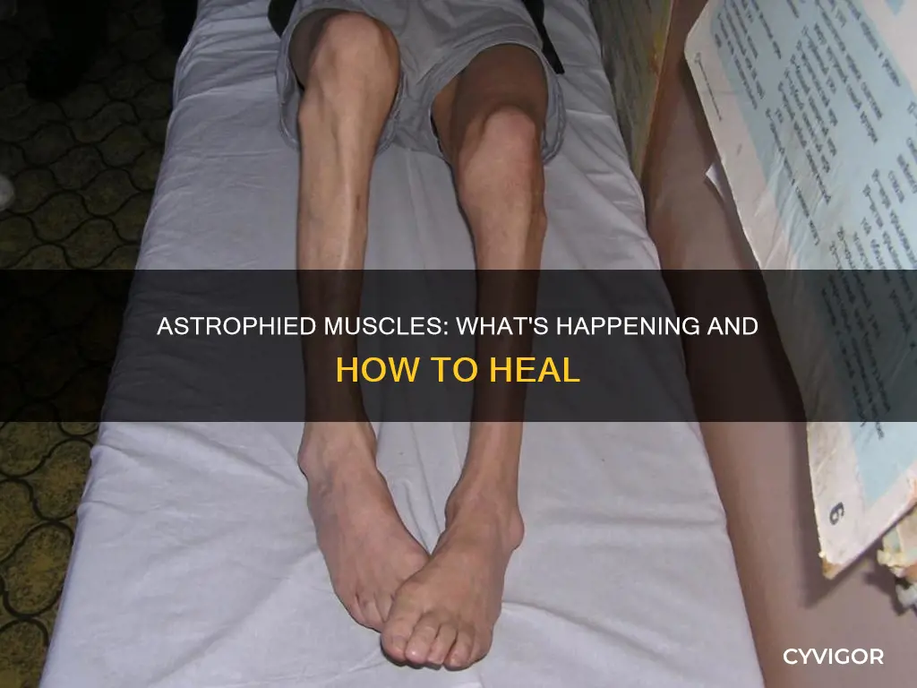 what does a astrphied muscles