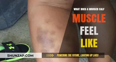 Understanding the Ache: What a Bruised Calf Muscle Feels Like