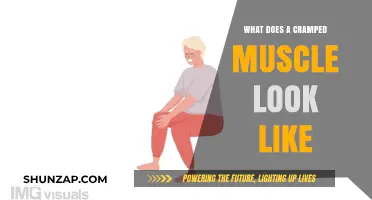 Understanding Muscle Cramps: Visual Signs and Symptoms Explained
